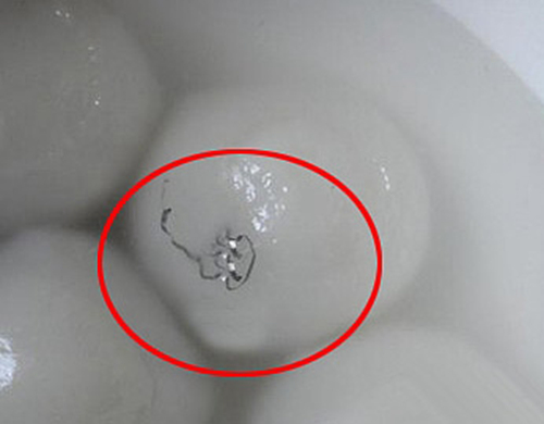 成都市民称汤圆里吃出钢丝 要厂家索赔十万